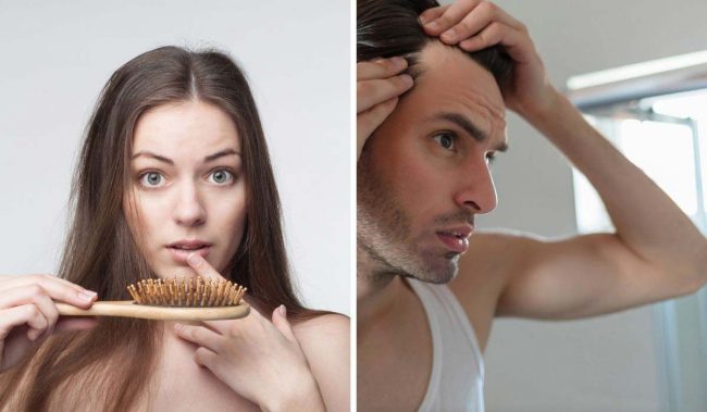 The Myths Surrounding Hair Loss